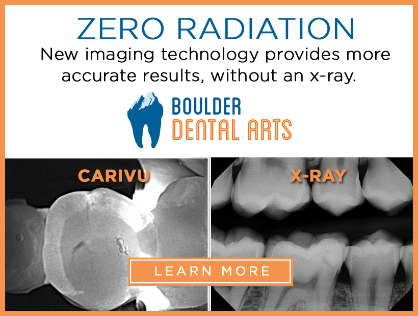 Radiation-Free Dentistry now at Boulder Dental Arts