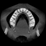 A 2D image of your teeth, but with CBCT we can get a 3D image of your teeth